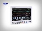 مانیتور علائم حیاتی صاایران مدل Cardioset ARAD P10 ساخت ایران