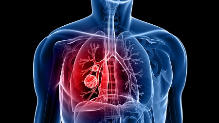بهترین تمرین‌های تنفسی برای بیماران مبتلا به COPD